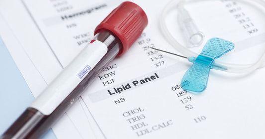 How to Support Healthy Cholesterol Levels Naturally: What the Research Says